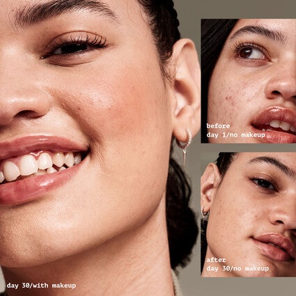 Before and After Using Acne Fighting Primer