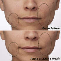 Before and After Applying Clarifying Facial Oil