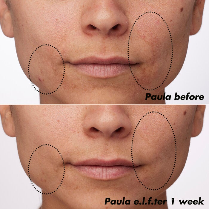 Before and After Applying Clarifying Facial Oil