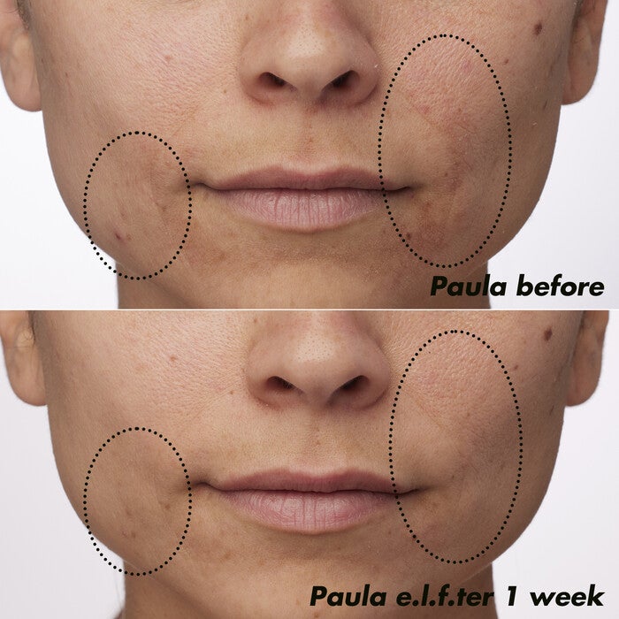 Before and After Applying Clarifying Facial Oil