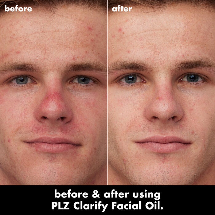 PLZ Clarify Facial Oil, 