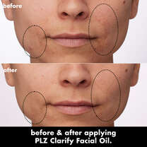 Before and After Applying Clarifying Facial Oil