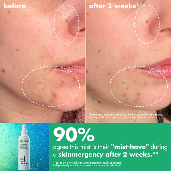Before and After Results of Using e.l.f. Hypochlorous Mist After 2 Weeks