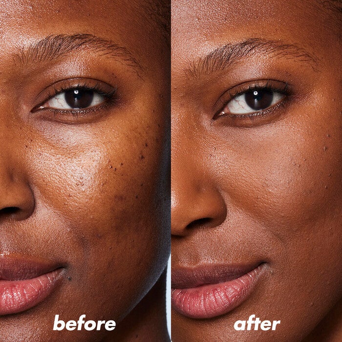 Before and After Use of Blue Color Corrector