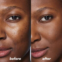 Before and After Use of Blue Color Corrector