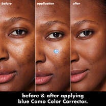 Before and After Use of Blue Color Corrector
