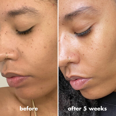Before and After Using Vitamin C Primer