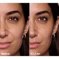 Before and After Applying Clear Sunscreen Stick SPF 50