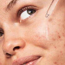 Blemish Breakthrough Triple-Acid Resurfacing Serum, 