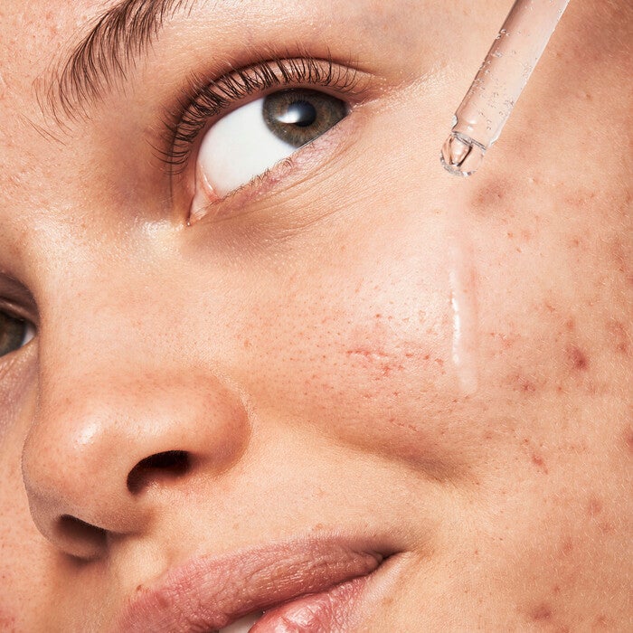 Blemish Breakthrough Triple-Acid Resurfacing Serum, 