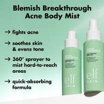 Acne Body Mist Fights Acne and Soothes Skin