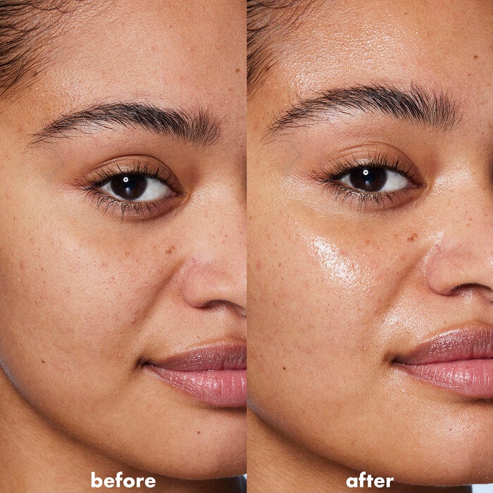 Before and After Application of Hyaluronic Serum