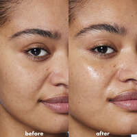 Before and After Application of Face Serum