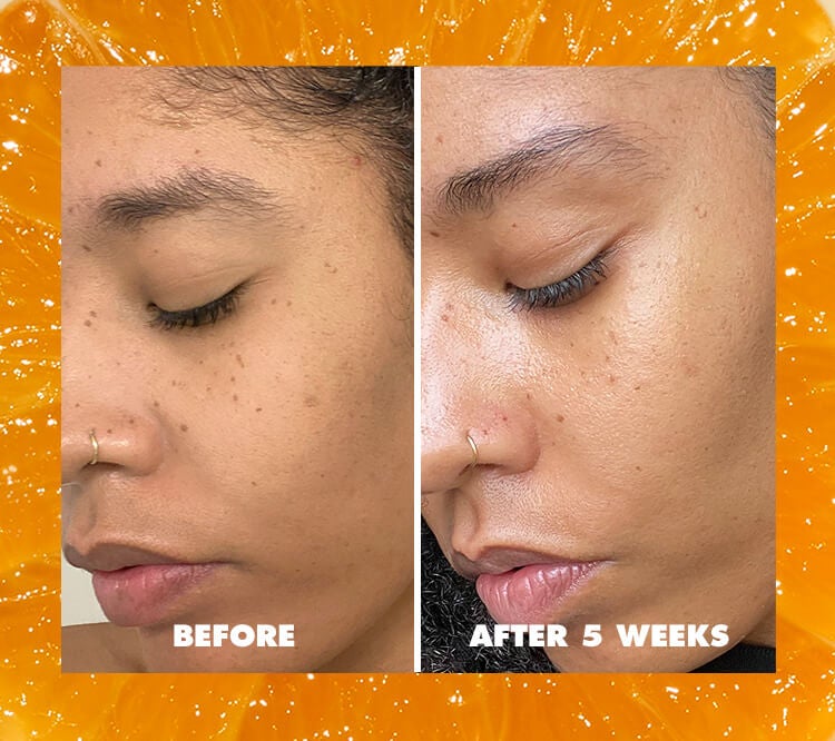 Before and After 5 Weeks